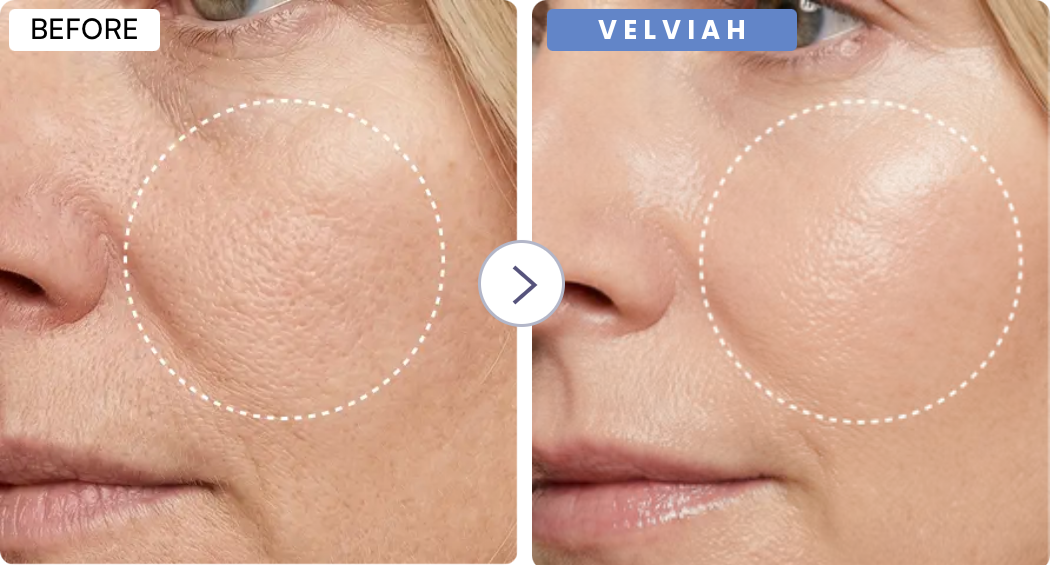 Velviah  ProGlow antiaging  Red Light Therapy  Mask