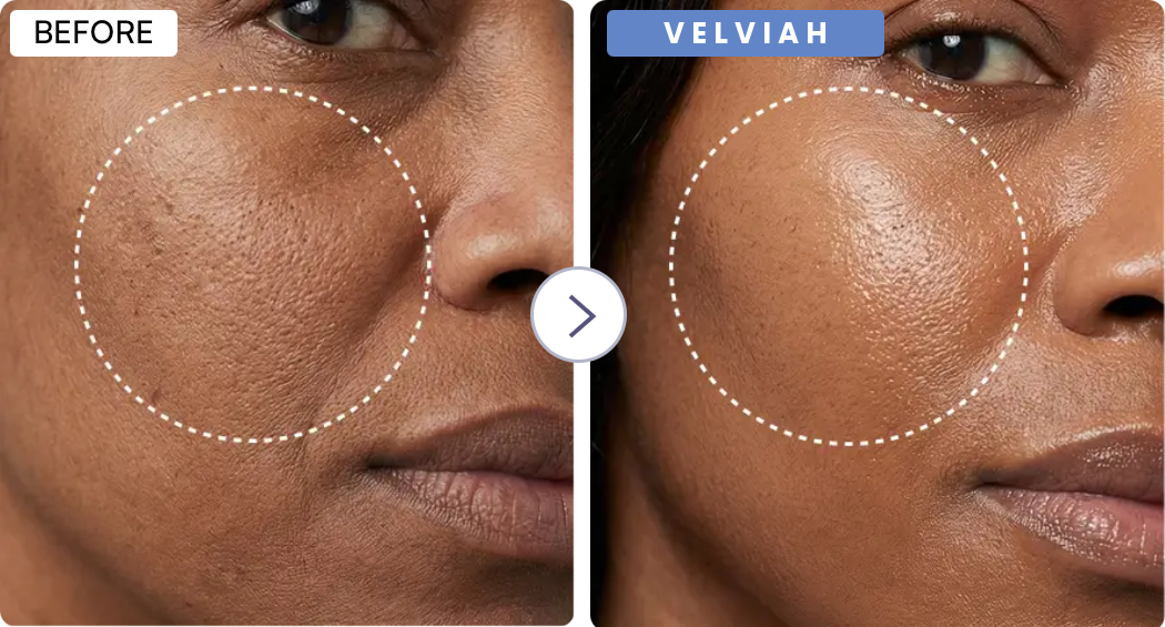 Velviah  ProGlow antiaging  Red Light Therapy  Mask