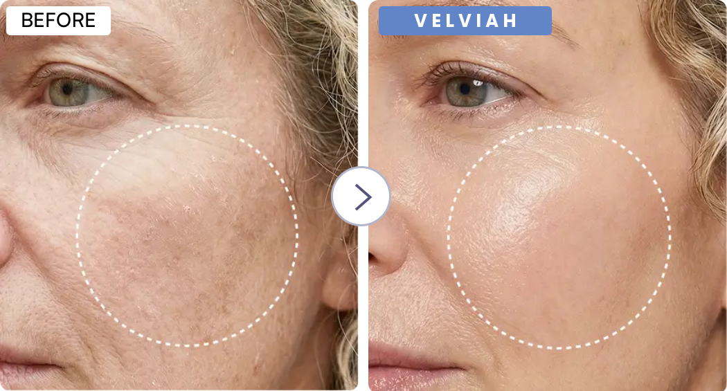 Velviah  ProGlow antiaging  Red Light Therapy  Mask