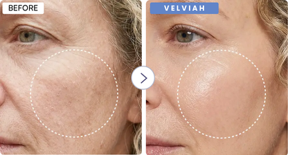 Velviah  ProGlow antiaging  Red Light Therapy  Mask