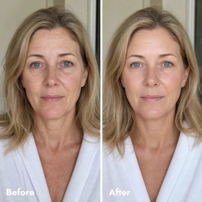 Volufiline salmon DNA bio-collagen volume Balm