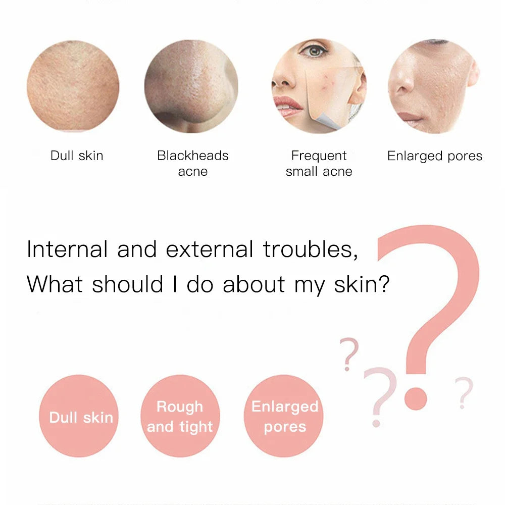 Ultrasonic Blackhead Remover and  Deep Cleansing for the skin