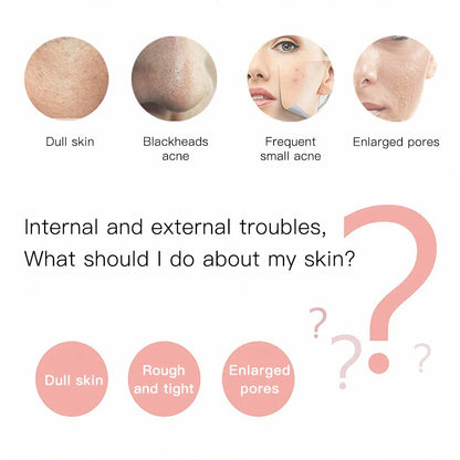 Ultrasonic Blackhead Remover and  Deep Cleansing for the skin