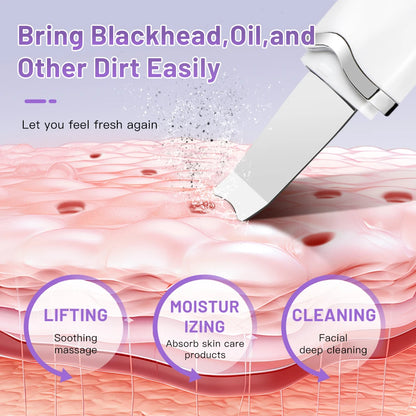Ultrasonic Blackhead Remover and  Deep Cleansing for the skin