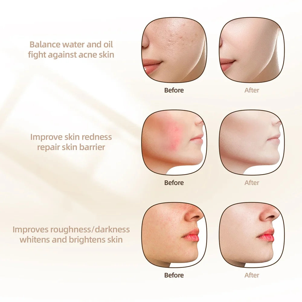 Deep Glow LED Anti Aging Mask