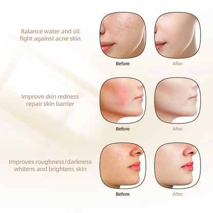 Deep Glow LED Anti Aging Mask