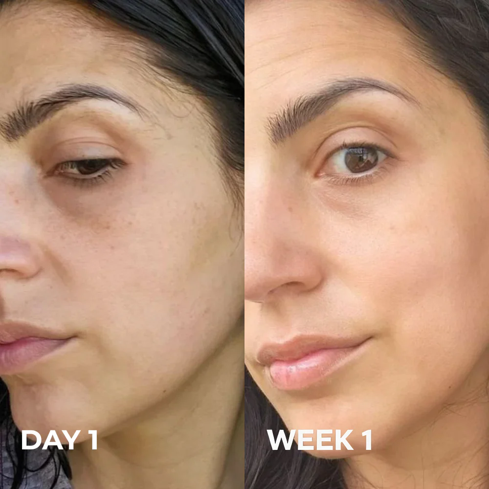 Velviah customer before and after results using the PDRN Volume Balm
