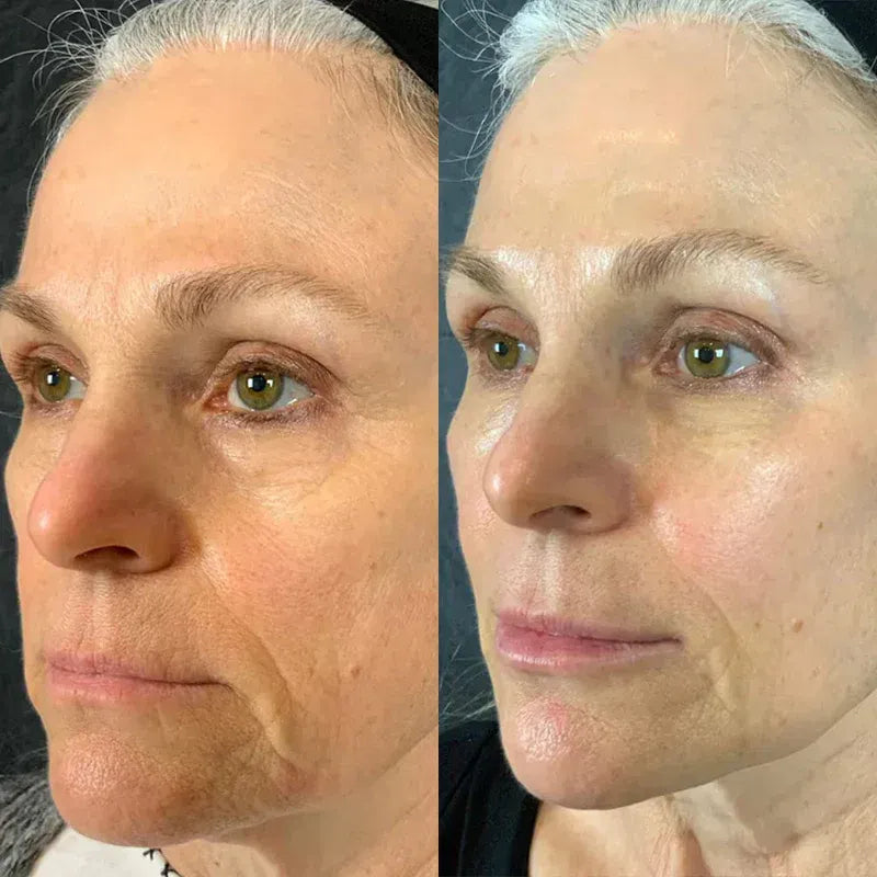 Velviah customer before and after results using the PDRN Volume Balm